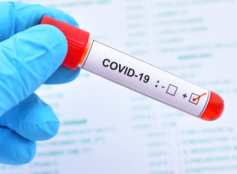 Анализ крови на антитела G и M к Covid 19>