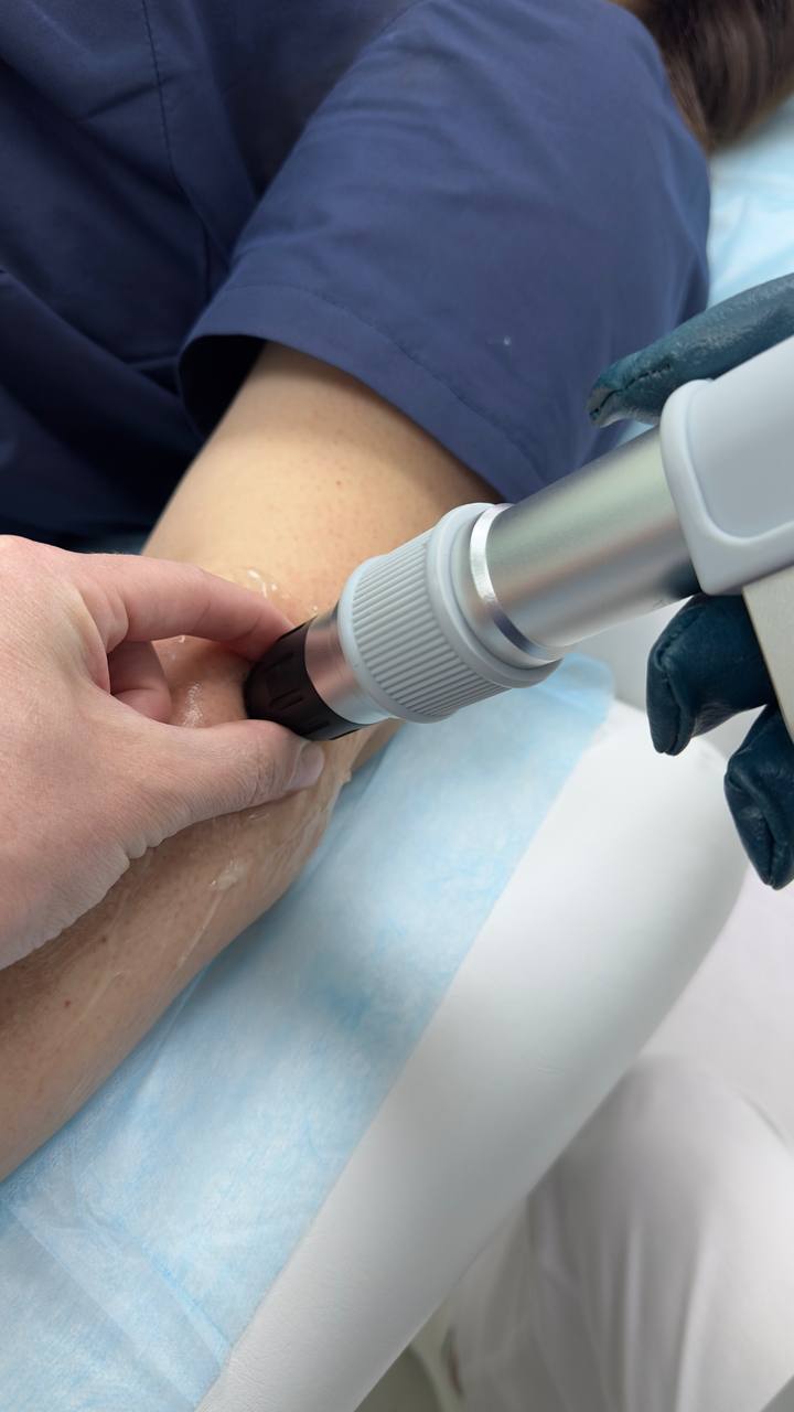 Ударно-волновая терапия