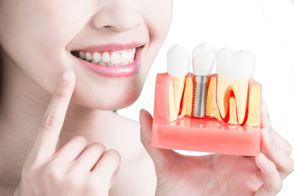 Специальная цена на зубные имплантаты в клинике «Дорсуммед»
